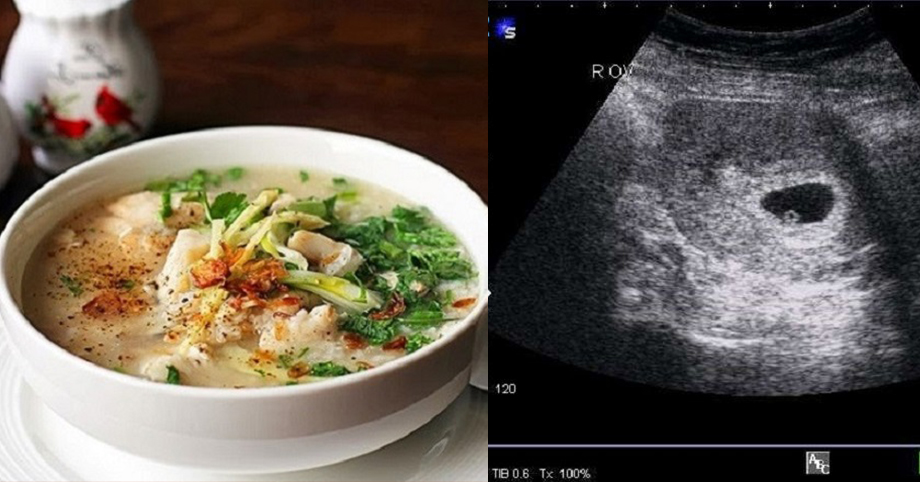 5 thực phẩm an thai tốt cho mẹ bầu trong 3 tháng đầu
