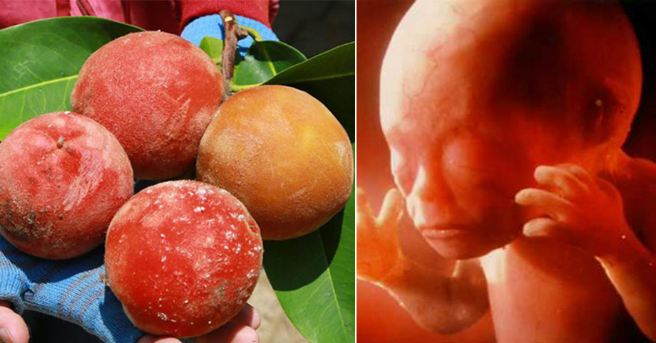 Mang thai 3 tháng đầu mẹ bầu cần tránh xa 4 loại trái cây này nếu không muốn mất con