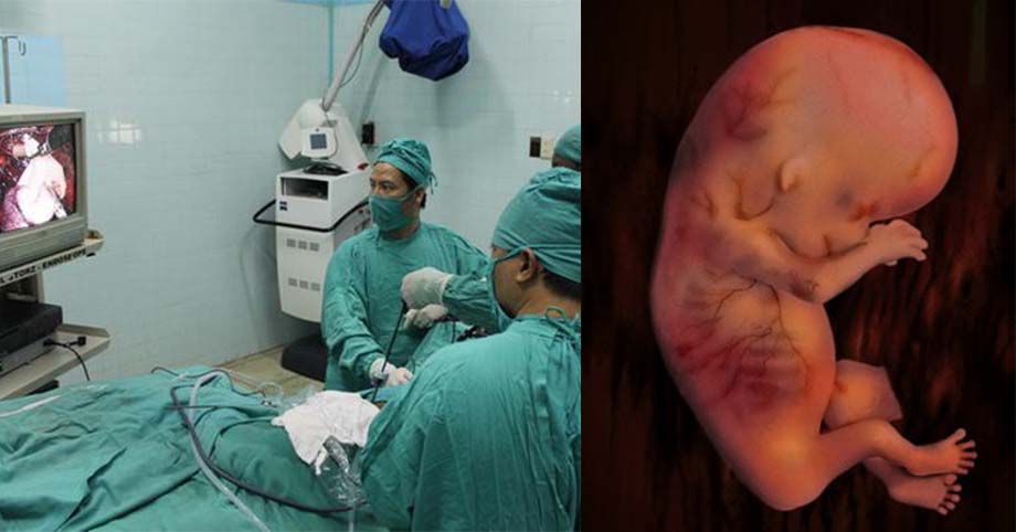 Không muốn thai nhi thiếu oxy, ngạt thở, mẹ bầu tuyệt đối không được làm 6 việc này