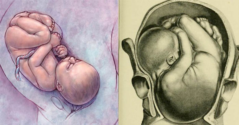 7 sai lầm của mẹ khiến thai nhi dị tật, não bộ chậm phát triển dẫn đến con sinh ra ngớ ngẩn