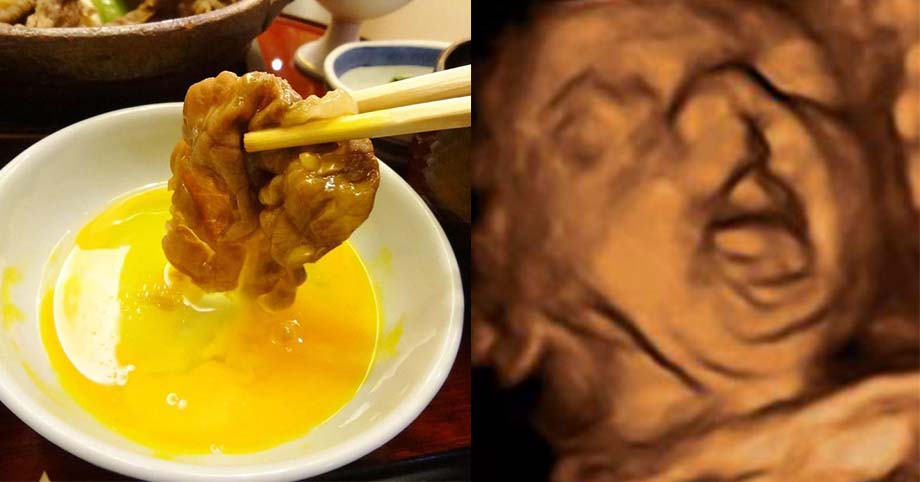 7 thực phẩm mẹ bầu cứ ăn bao nhiêu con tăng nguy cơ bị dị dạng bấy nhiêu