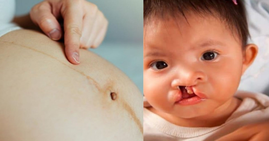 Ba mẹ cần hết sức lưu ý những thời điểm thụ thai dễ khiến thai nhi dị tật