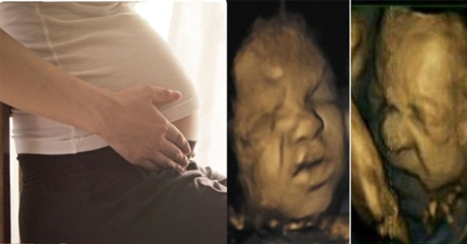 4 kiểu ngồi của bà bầu khiến thai nhi thiếu oxy dễ bị ngộp, mẹ nên bỏ ngay để con được khỏe mạnh
