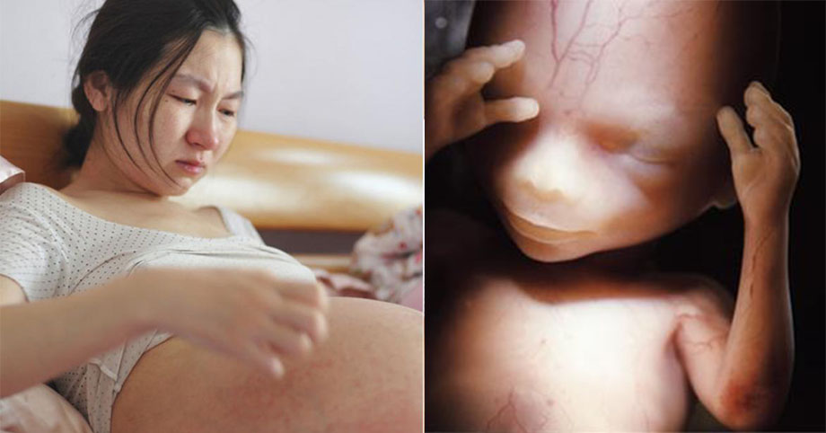 3 bộ phận khi mang thai mẹ tuyệt đối không nên chạm vào kẻo 𝚜ả𝚢 𝚝𝚑𝚊𝚒 𝚜𝚒𝚗𝚑 𝚗𝚘𝚗