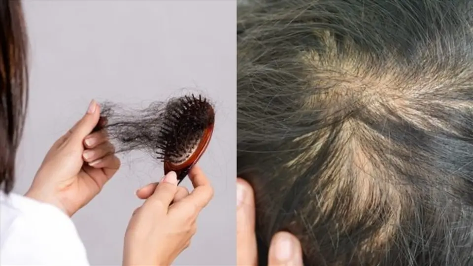 10 thực phẩm giúp mẹ thoát cảnh tóc rụng như trút sau sinh