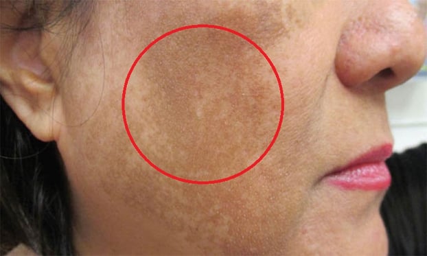 4 lý do khiến da đen sạm, xỉn màu trong mùa đông dù ít tiếp xúc ánh nắng, làm cách nào để khắc phục?